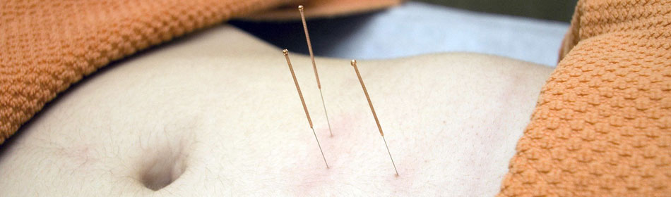 Accupuncture, Eastern Healing Arts in the Clinton, Hunterdon County NJ area